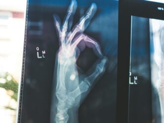 Google’s Open MedGemma AI Models May Revolutionize Healthcare